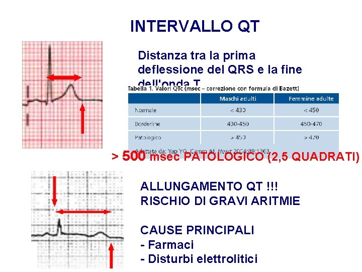 Advanced Cardiac Life Support Gruppo RCP ANMCO - ITO AHA INTERVALLO QT Distanza tra