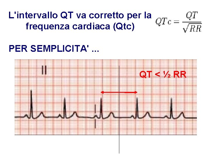 Advanced Cardiac Life Support Gruppo RCP ANMCO - ITO AHA L'intervallo QT va corretto