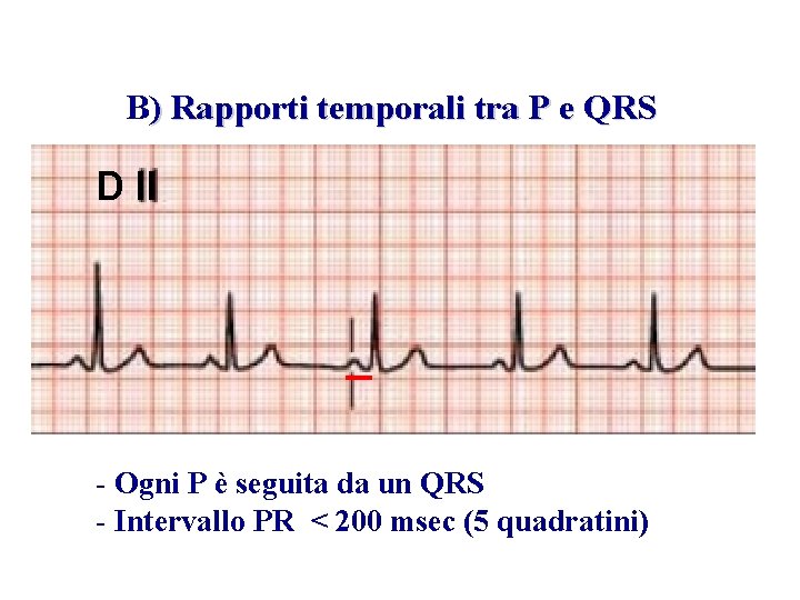 Advanced Cardiac Life Support Gruppo RCP ANMCO - ITO AHA B) Rapporti temporali tra