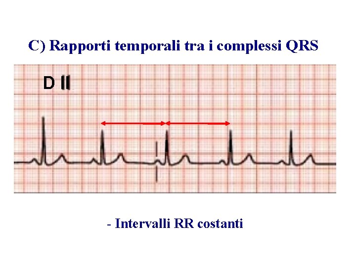 Advanced Cardiac Life Support Gruppo RCP ANMCO - ITO AHA C) Rapporti temporali tra