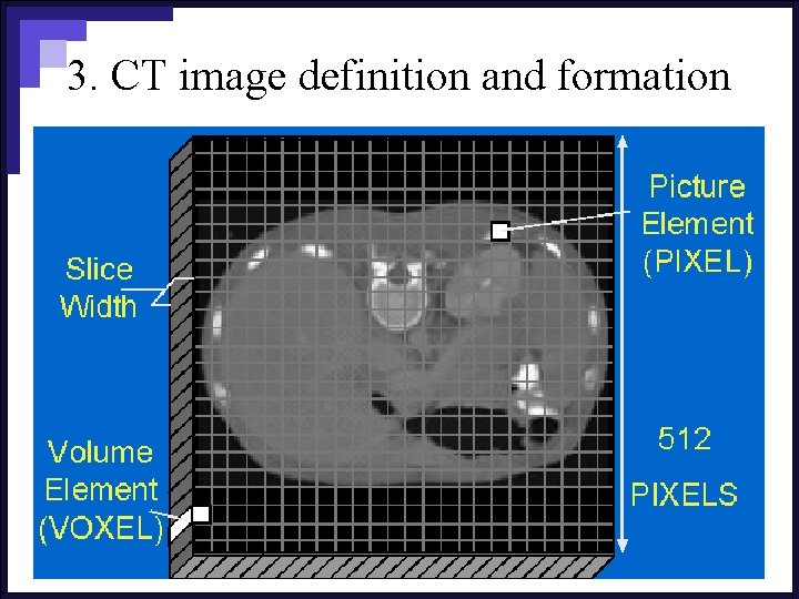 3. CT image definition and formation 