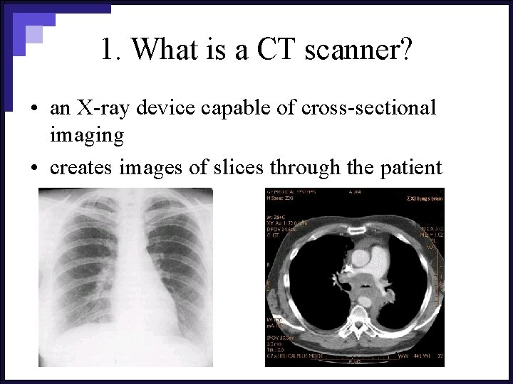 1. What is a CT scanner? • an X-ray device capable of cross-sectional imaging