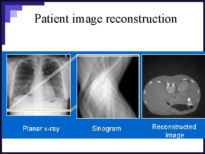 Patient image reconstruction 