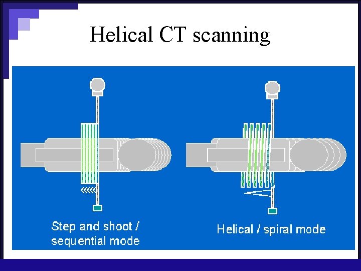 Helical CT scanning 