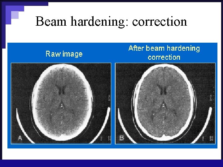 Beam hardening: correction 