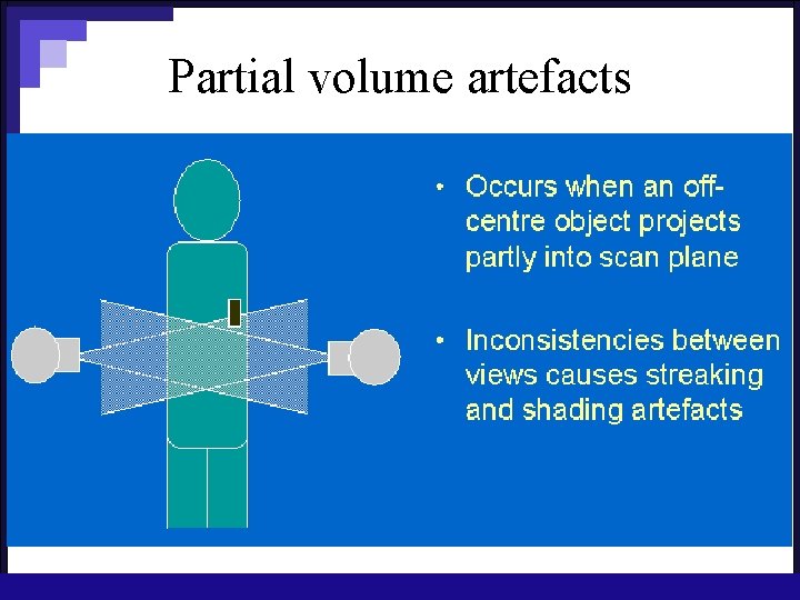 Partial volume artefacts 