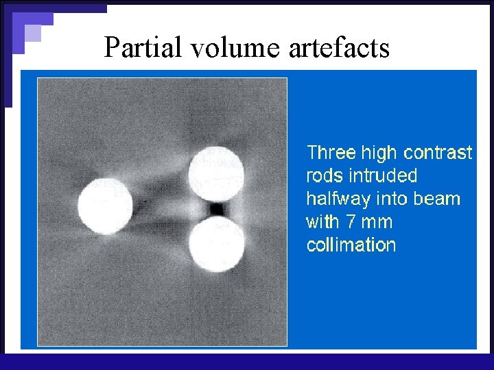 Partial volume artefacts 