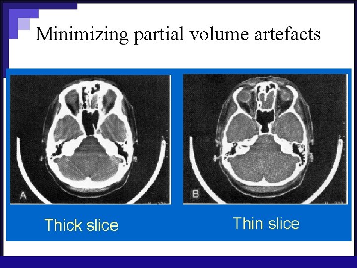 Minimizing partial volume artefacts 