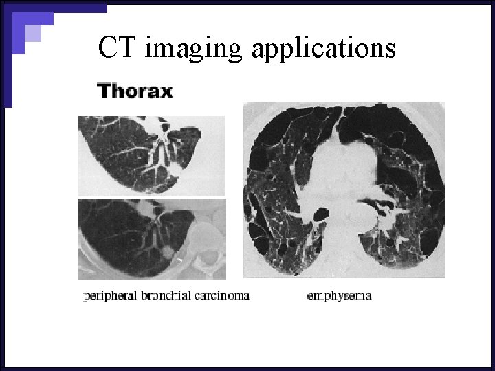 CT imaging applications 