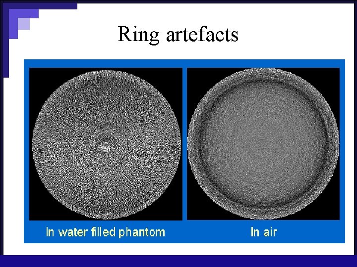 Ring artefacts 