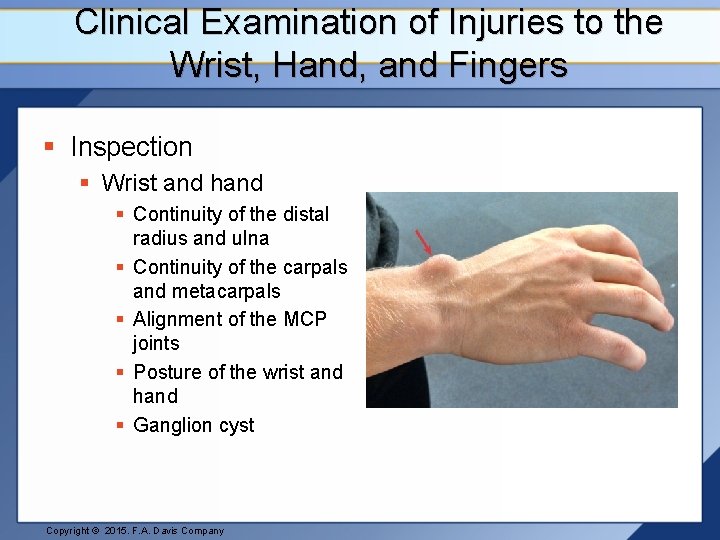 Clinical Examination of Injuries to the Wrist, Hand, and Fingers § Inspection § Wrist