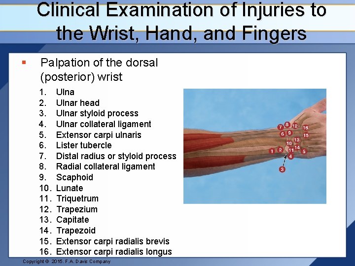 Clinical Examination of Injuries to the Wrist, Hand, and Fingers § Palpation of the