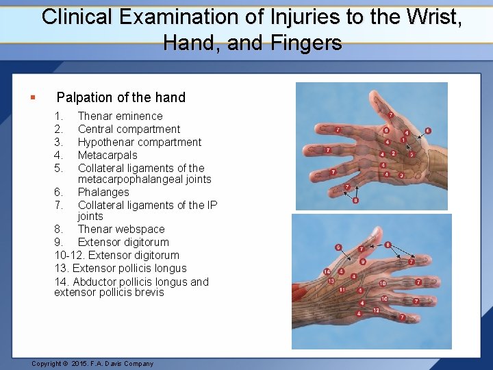 Clinical Examination of Injuries to the Wrist, Hand, and Fingers § Palpation of the