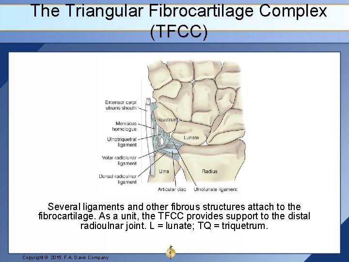 The Triangular Fibrocartilage Complex (TFCC) Several ligaments and other fibrous structures attach to the