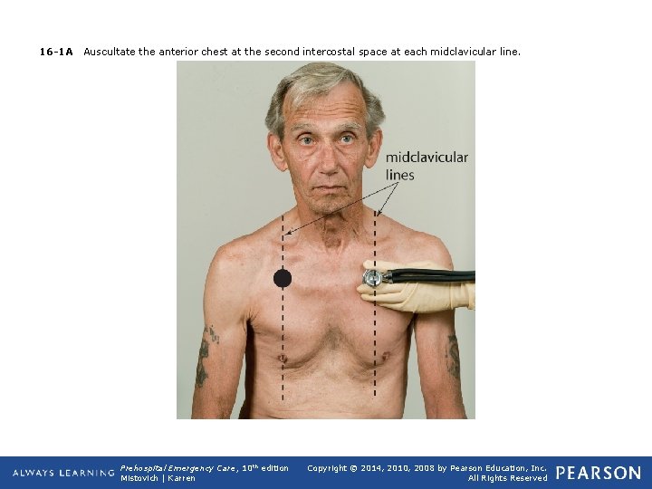 16 -1 A Auscultate the anterior chest at the second intercostal space at each