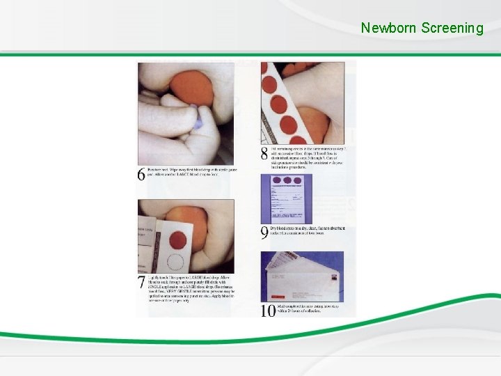 Newborn Screening Newborn Screening