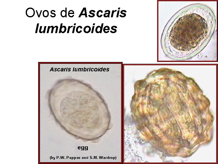 Ovos de Ascaris lumbricoides Ovos de Ascaris lumbricoides