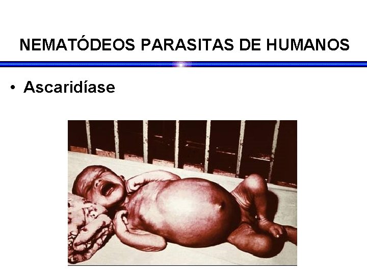 NEMATÓDEOS PARASITAS DE HUMANOS • Ascaridíase NEMATÓDEOS PARASITAS DE HUMANOS • Ascaridíase