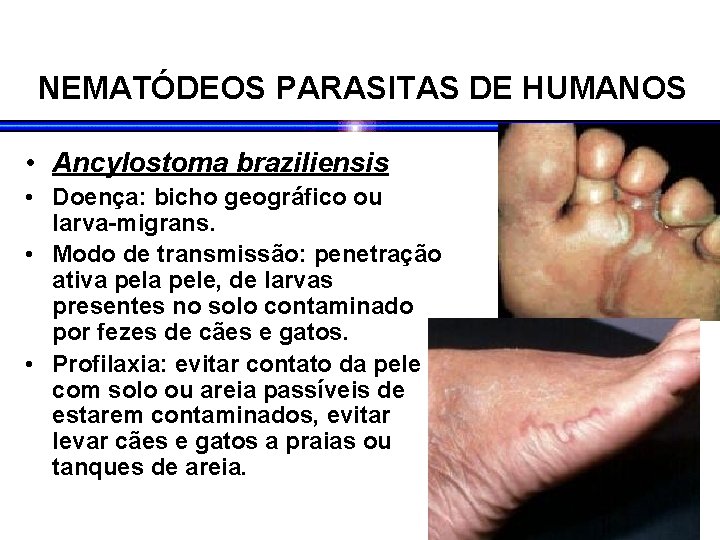 NEMATÓDEOS PARASITAS DE HUMANOS • Ancylostoma braziliensis • Doença: bicho geográfico ou larva-migrans. • NEMATÓDEOS PARASITAS DE HUMANOS • Ancylostoma braziliensis • Doença: bicho geográfico ou larva-migrans. •