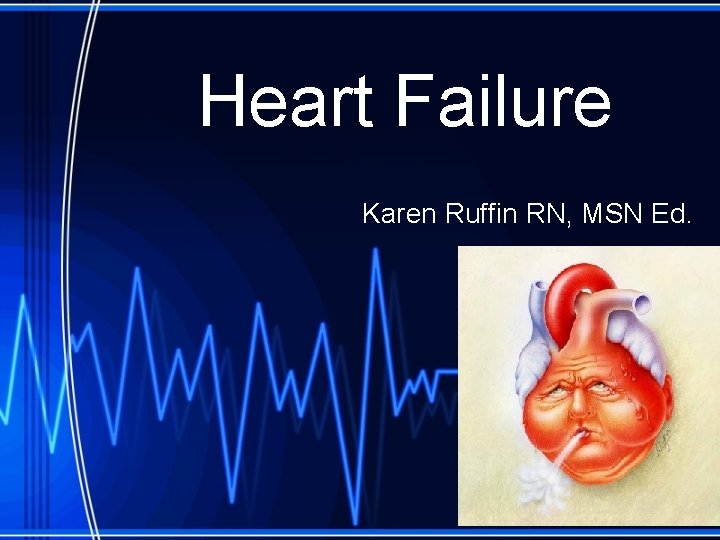 Heart Failure Karen Ruffin RN, MSN Ed. 