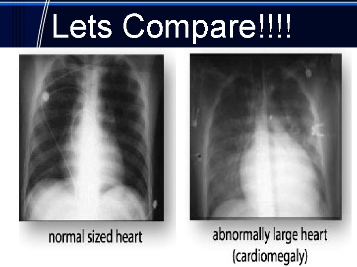 Lets Compare!!!! 