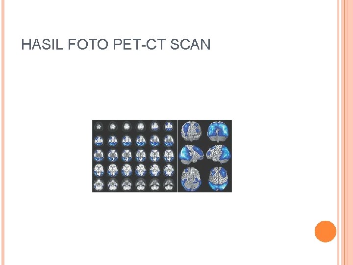 HASIL FOTO PET-CT SCAN 
