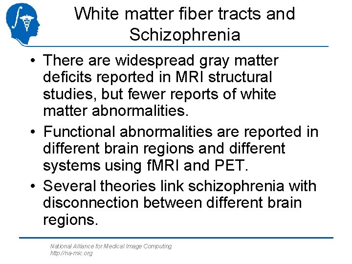 White matter fiber tracts and Schizophrenia • There are widespread gray matter deficits reported