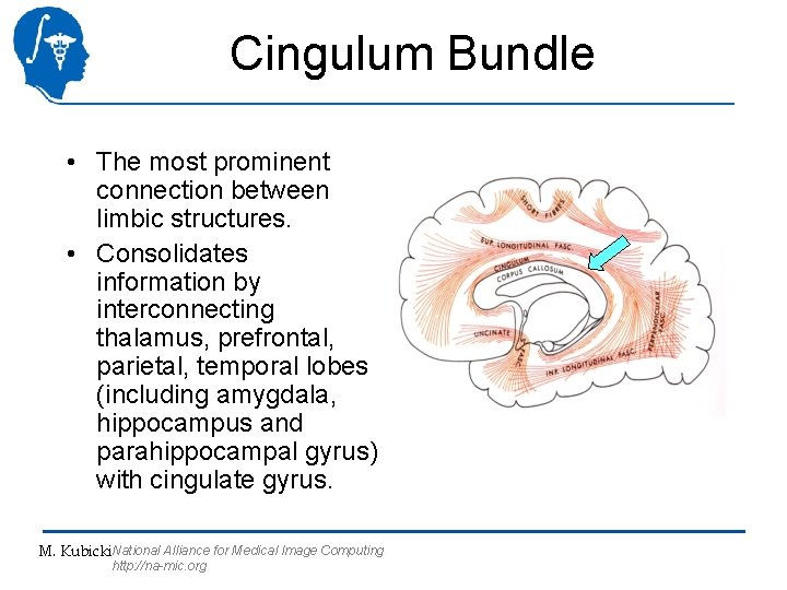 Cingulum Bundle • The most prominent connection between limbic structures. • Consolidates information by