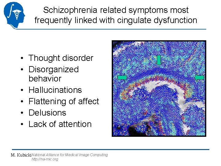 Schizophrenia related symptoms most frequently linked with cingulate dysfunction • Thought disorder • Disorganized