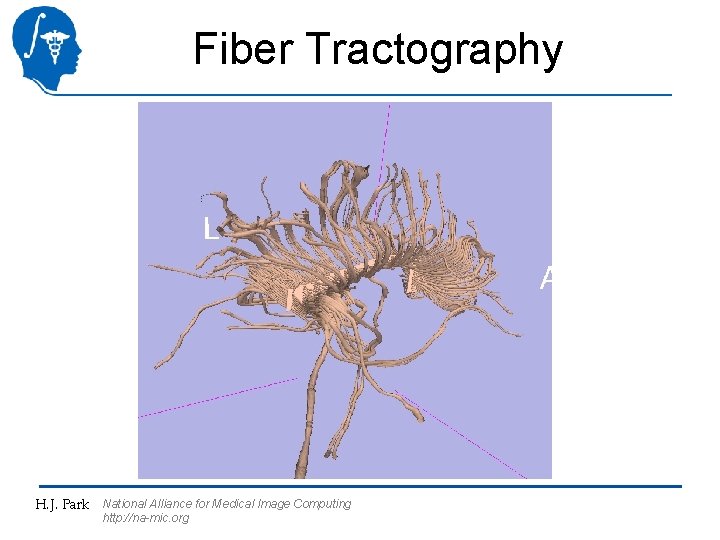 Fiber Tractography H. J. Park National Alliance for Medical Image Computing http: //na-mic. org
