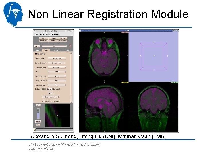 Non Linear Registration Module Alexandre Guimond, Lifeng Liu (CNI), Matthan Caan (LMI). National Alliance