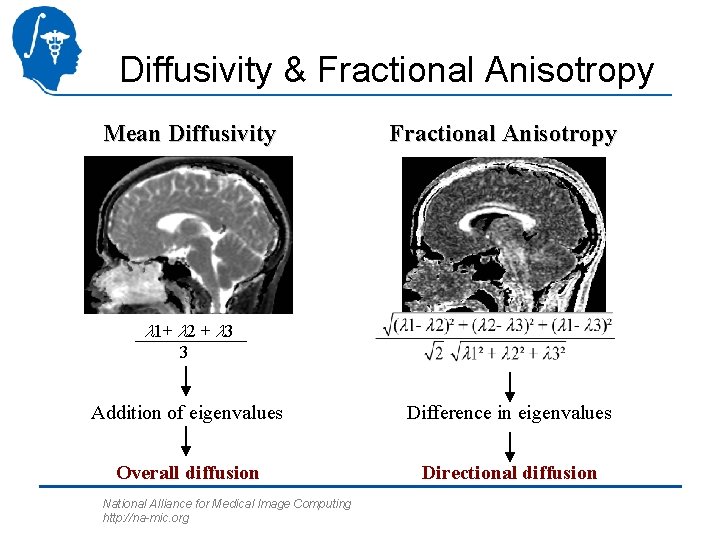 Diffusivity & Fractional Anisotropy Mean Diffusivity Fractional Anisotropy l 1+ l 2 + l