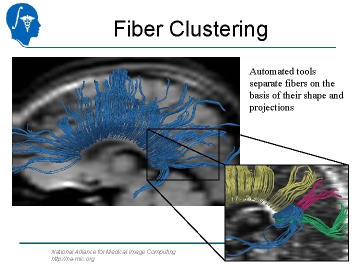 Fiber Clustering Automated tools separate fibers on the basis of their shape and projections