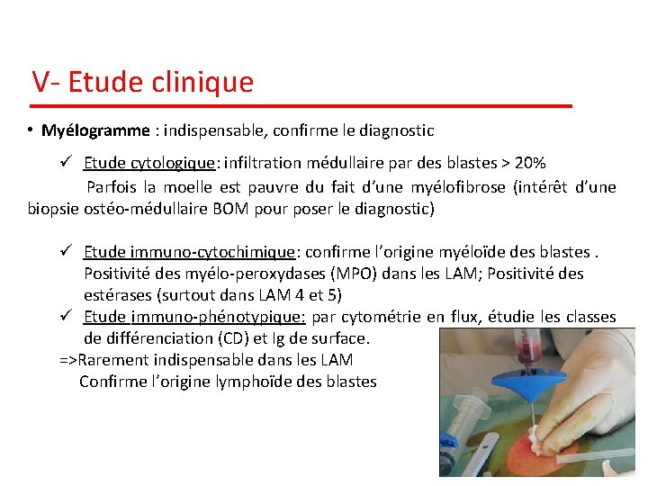 V- Etude clinique • Myélogramme : indispensable, confirme le diagnostic ü Etude cytologique: infiltration