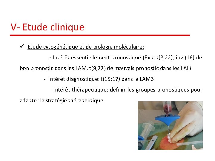 V- Etude clinique ü Etude cytogénétique et de biologie moléculaire: - Intérêt essentiellement pronostique