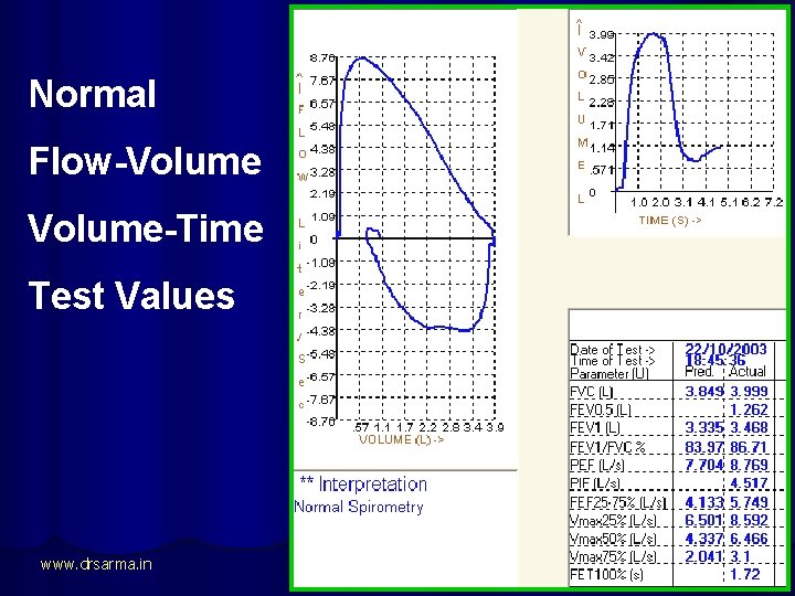 Normal Flow-Volume-Time Test Values www. drsarma. in 