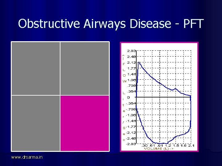 Obstructive Airways Disease - PFT FEV 1 is LOW FVC is Normal FEV 1