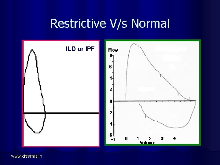 Restrictive V/s Normal ILD or IPF www. drsarma. in 