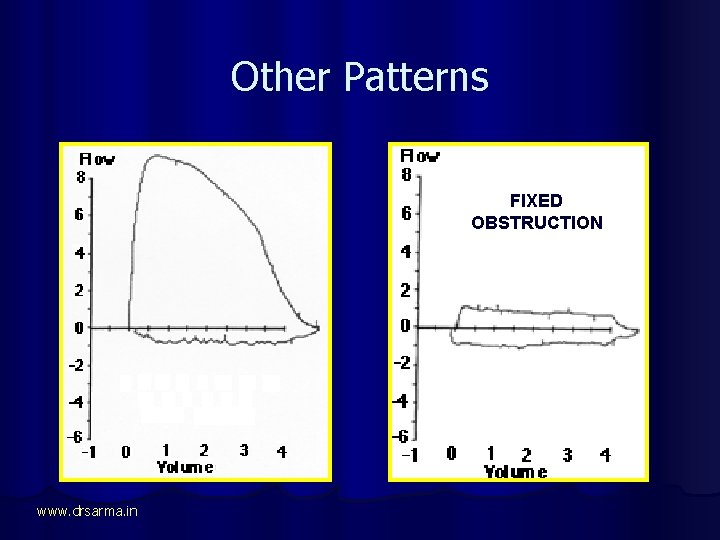 Other Patterns FIXED OBSTRUCTION www. drsarma. in 