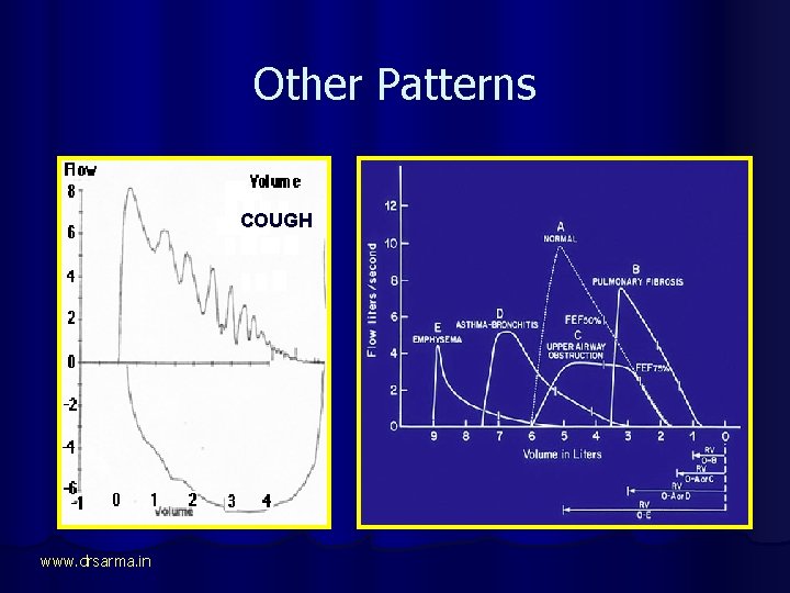 Other Patterns COUGH EXTRA THORACIC www. drsarma. in 