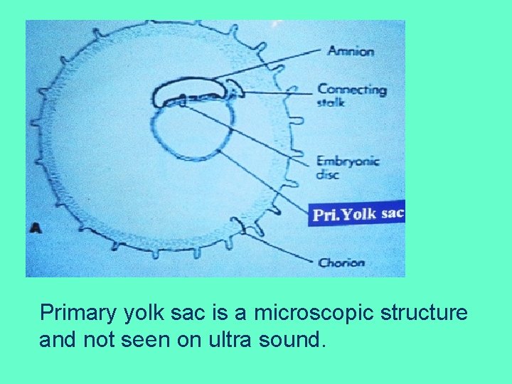 Primary yolk sac is a microscopic structure and not seen on ultra sound. 