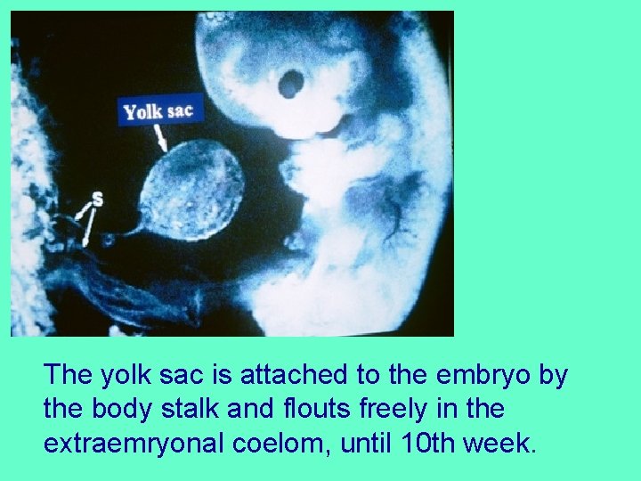 The yolk sac is attached to the embryo by the body stalk and flouts