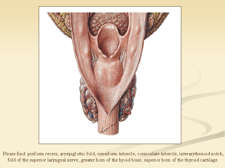 Please find: piriform recess, aryepiglottic fold, cuneiform tubercle, corniculate tubercle, interarythenoid notch, fold of