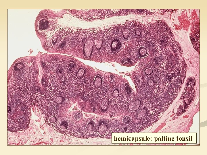 hemicapsule: paltine tonsil 