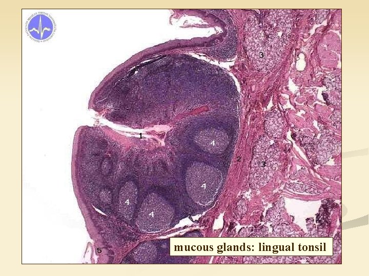 mucous glands: lingual tonsil 