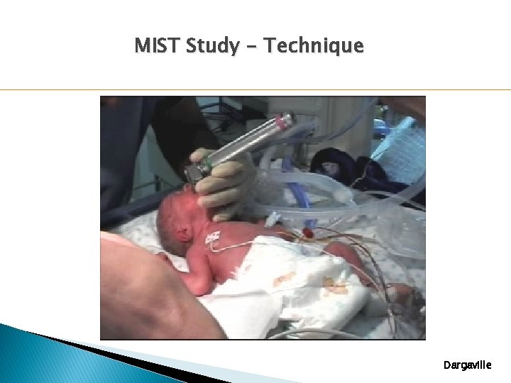 MIST Study - Technique Dargaville MIST Study - Technique Dargaville
