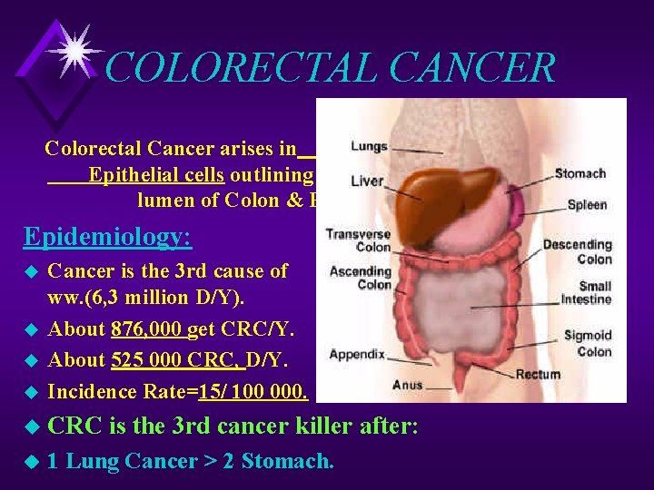 COLORECTAL CANCER Colorectal Cancer arises in Epithelial cells outlining the lumen of Colon &