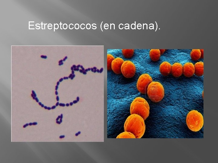 Estreptococos (en cadena). 