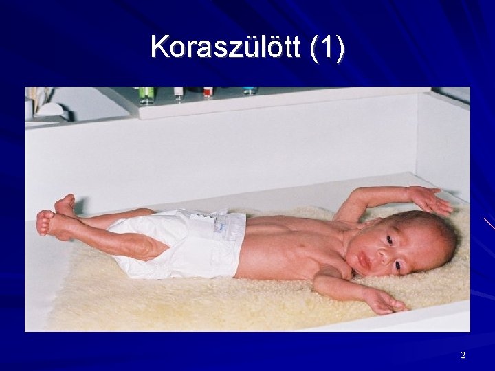 Koraszülött (1) 2 Koraszülött (1) 2
