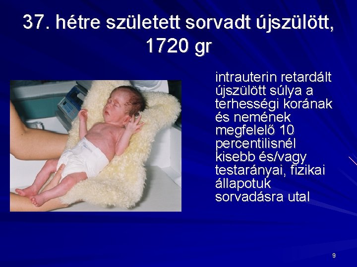 37. hétre született sorvadt újszülött, 1720 gr intrauterin retardált újszülött súlya a terhességi korának